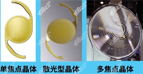 白内障手术改善有哪些方法？