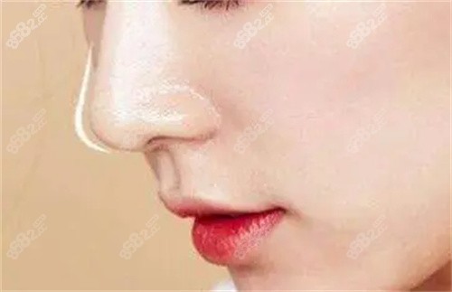 杭州奥拉克医疗美容鼻部整形价格表