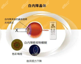 晶体放入位置