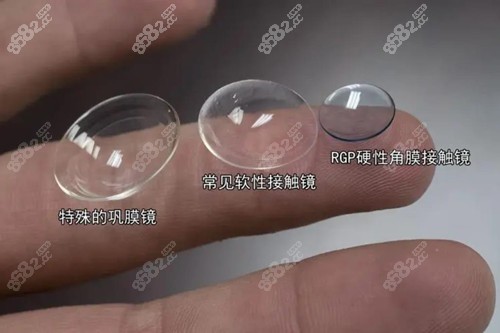 巩膜镜为什么国内不引进