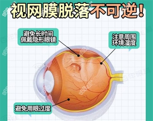 视网膜脱落做手术多少钱