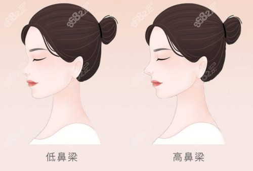 深圳鼻修复整形医院排名