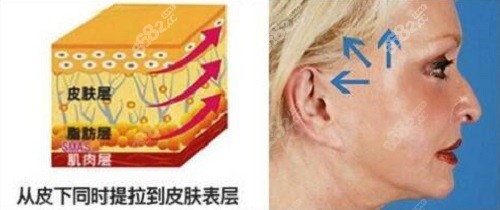 上海倪锋医生怎么预约挂号