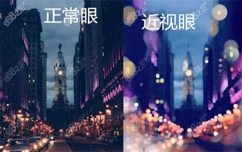 做完近视手术后需要注意哪些事项