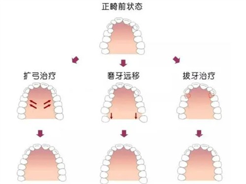 哈尔滨美植口腔做牙齿矫正技术成熟