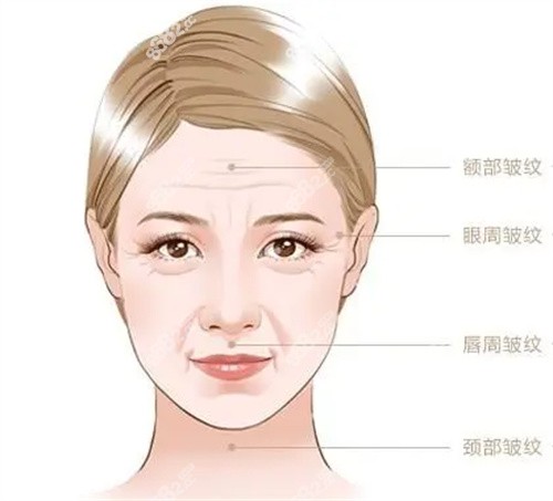 韩国脸部筋膜提升医院医生排名