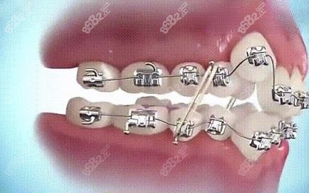 莆田万辉口腔牙齿矫正