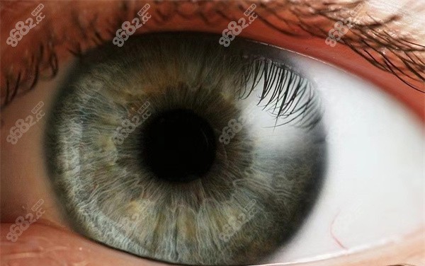 近视手术 近视手术