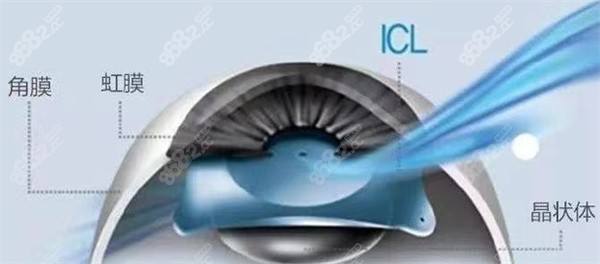 线上眼科免费24小时咨询 线上眼科免费24小时咨询