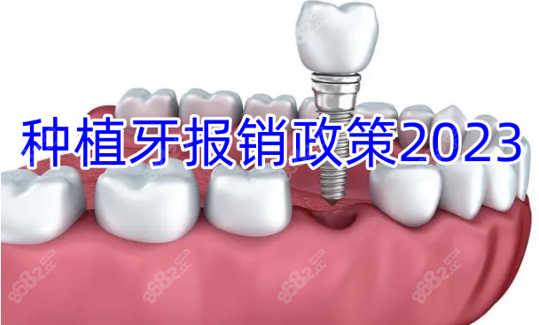 种植牙报销政策2023
