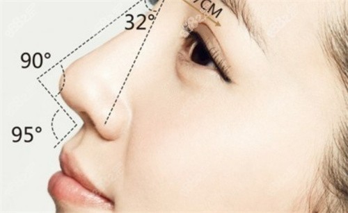 成都艾米麗整形醫(yī)院做鼻子哪個醫(yī)生好？