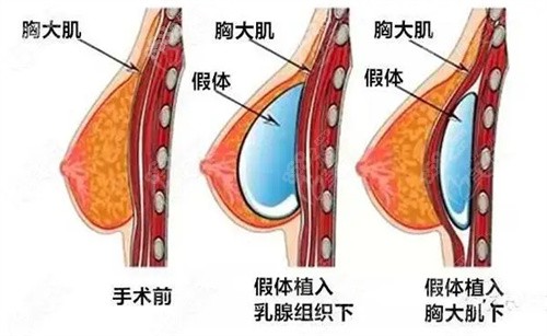 武汉艺星杨国梁