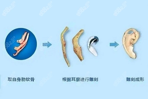 河南张正文耳再造口碑怎么样？