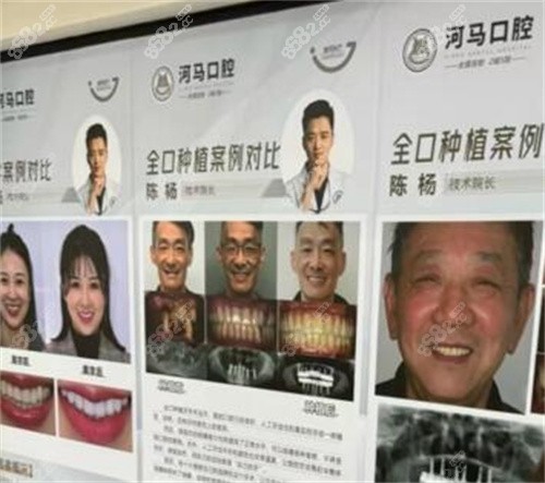 重庆河马口腔种植牙多少钱？