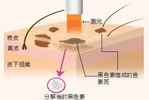 重庆艺星医疗美容医院祛斑怎么样?网友都说做祛斑很有效