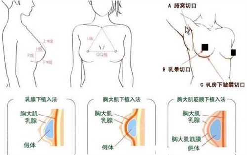 李<!--<i data=20240705-sp></i>-->隆胸预约挂号方式流程