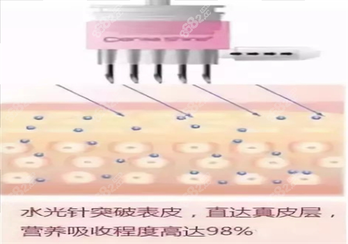 重庆军科水光|针