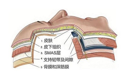 <!--<i data=20240705-sp></i>-->李晓东医生拉皮提升技术