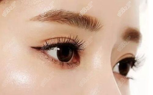 北京柏麗史迎軍做眼睛手術(shù)怎么樣