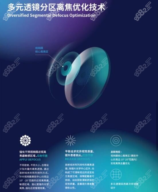 20231016900奥拉怒放近视管理镜片的特点和优势m.8682.cc721.jpg