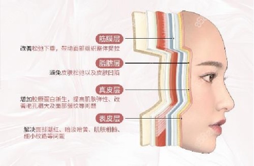 瞿健医生拉皮手术技术优势