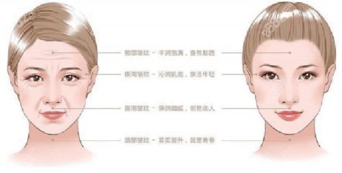 北京华韩瞿健医生拉皮手术怎么样