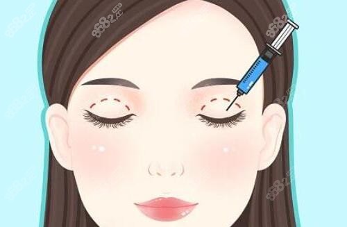 高亞?wèn)|做雙眼皮修復(fù)怎么樣