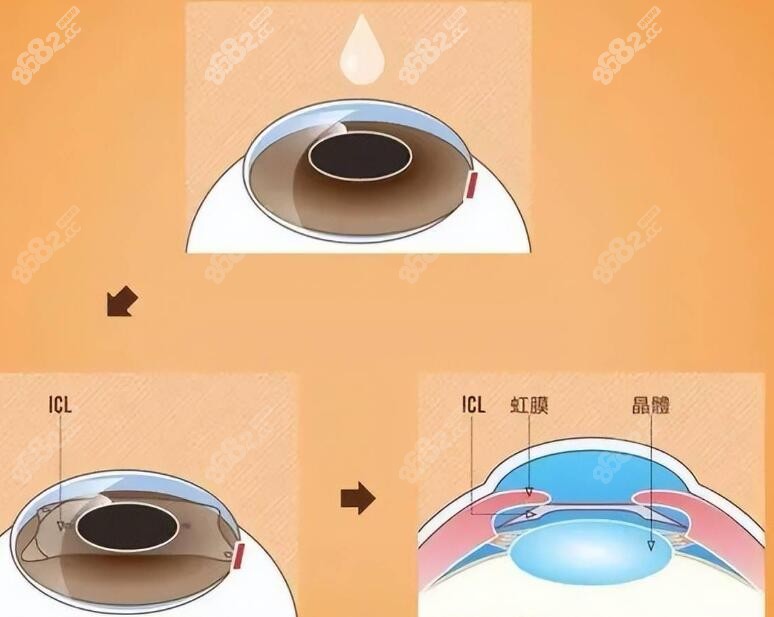 北京民众眼科医院怎么样