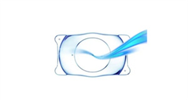 全飛秒近視手術(shù)后多久能恢復(fù)