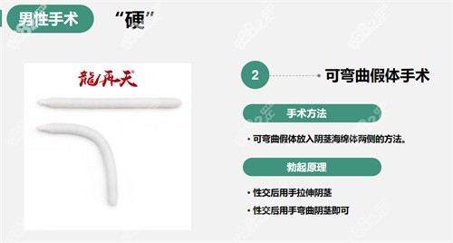 阴茎假体植入手术哪家医院可以做？