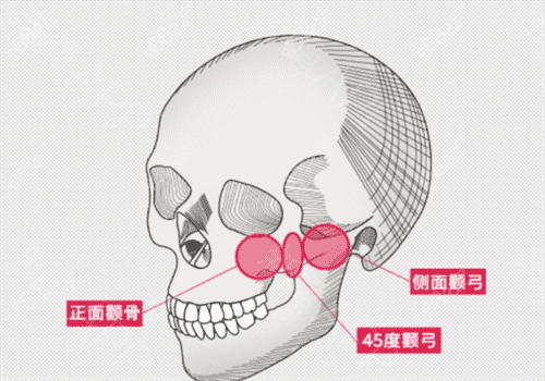 北京圣嘉新医疗美容医院手术图
