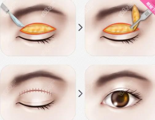 哈爾濱宋桂霞眼修復(fù)價(jià)格