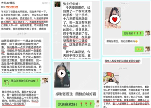 长沙爱思特张姣姣修复双眼皮的价格大概多钱？