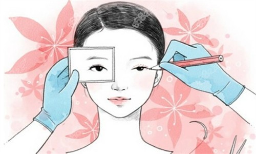 刘志刚眼修复做的怎么样