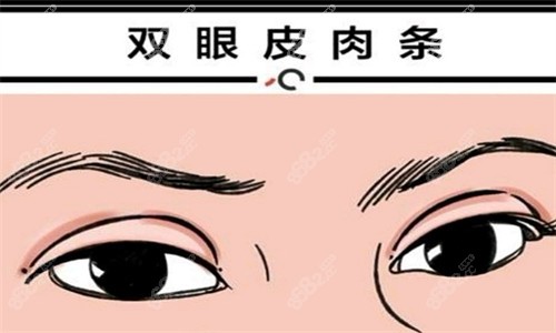 刘志刚眼修复多少钱