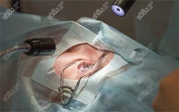 近视手术费用可以医疗保险报销吗