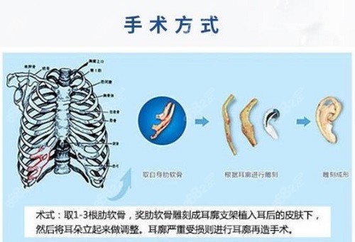 郑州赵绛波要提前预约吗