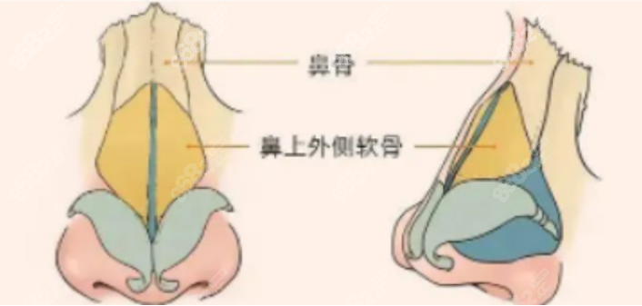巫文云医生隆鼻
