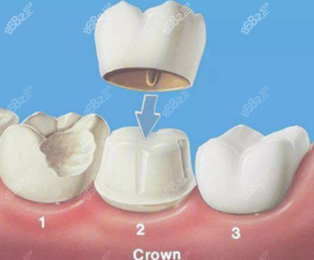 乌鲁木齐天牙口腔门诊种植牙