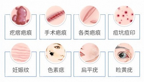 疤痕修复手术价格是多少？