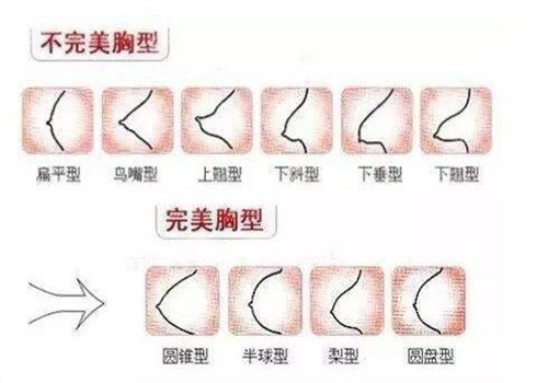 沈阳北方整形医院胸部整形价格表