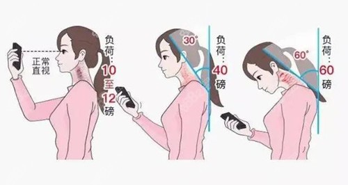 北京嘉禾整形医院做富贵包手术好吗