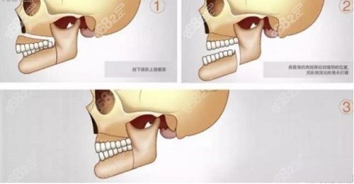 唐冬生的磨骨技术怎么样