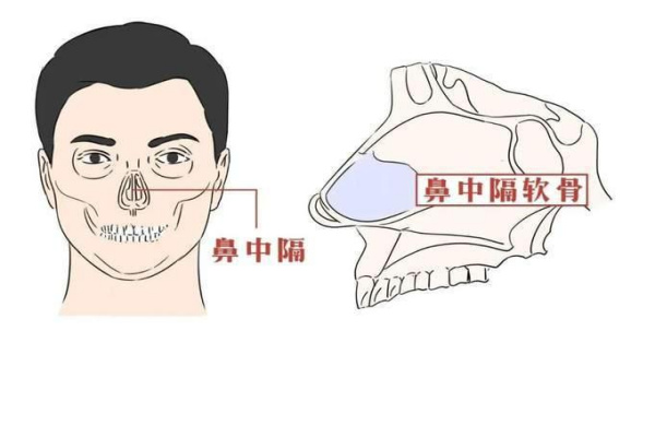 余文林歪鼻矫正案例:唇腭裂歪鼻|鼻中隔偏曲|外伤歪鼻病例