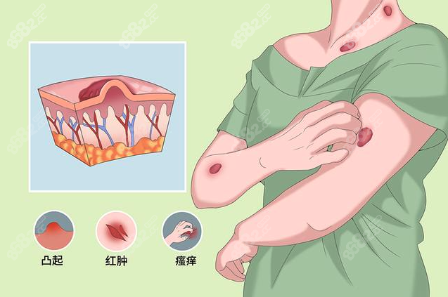 疤痕修复能恢复到什么程度