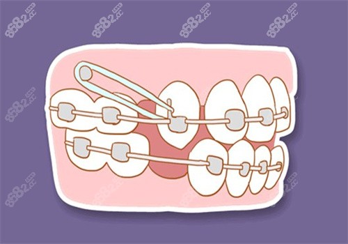 福州维乐口腔牙齿矫正怎么样