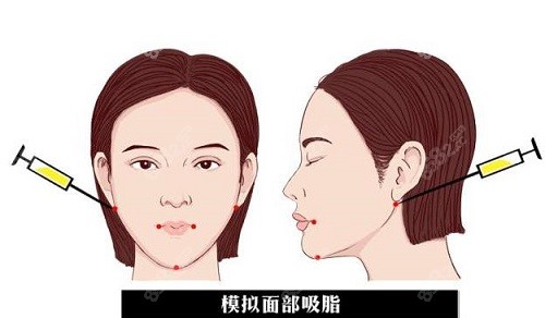 潘红伟医生有名吗