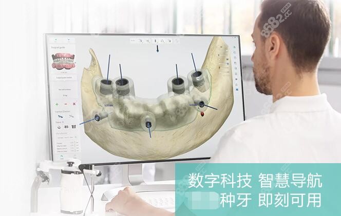 深圳麦芽口腔种牙靠不靠谱