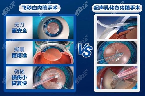 飞秒白内障费用医疗保险能报销吗