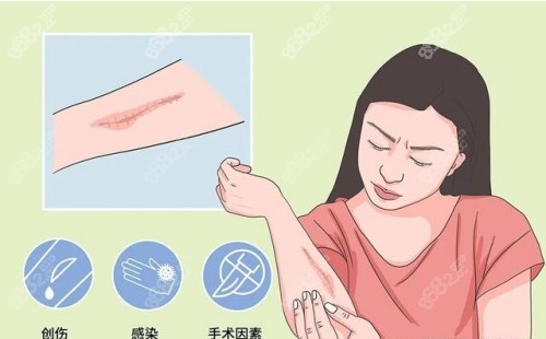 北京祛疤哪家医院好? 北京祛疤哪家医院好?